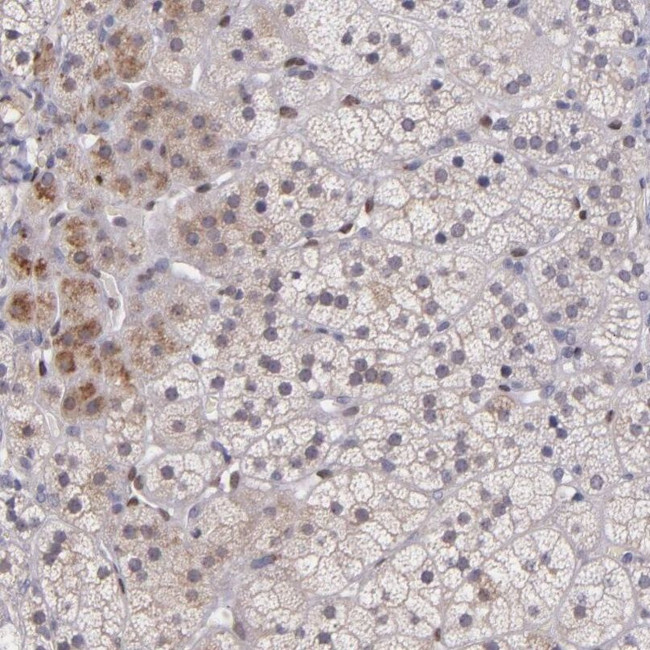NUP62CL Antibody in Immunohistochemistry (IHC)