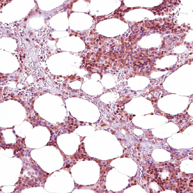 NFE2 Antibody in Immunohistochemistry (IHC)