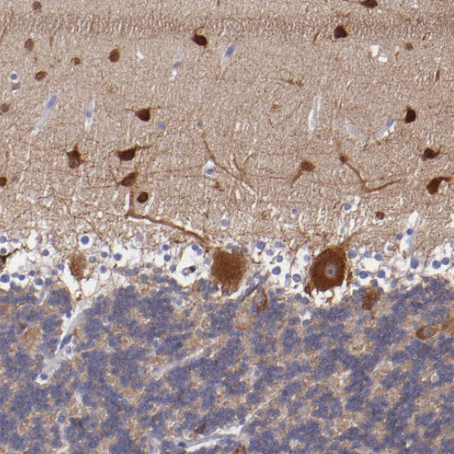 RAP1GAP Antibody in Immunohistochemistry (Paraffin) (IHC (P))