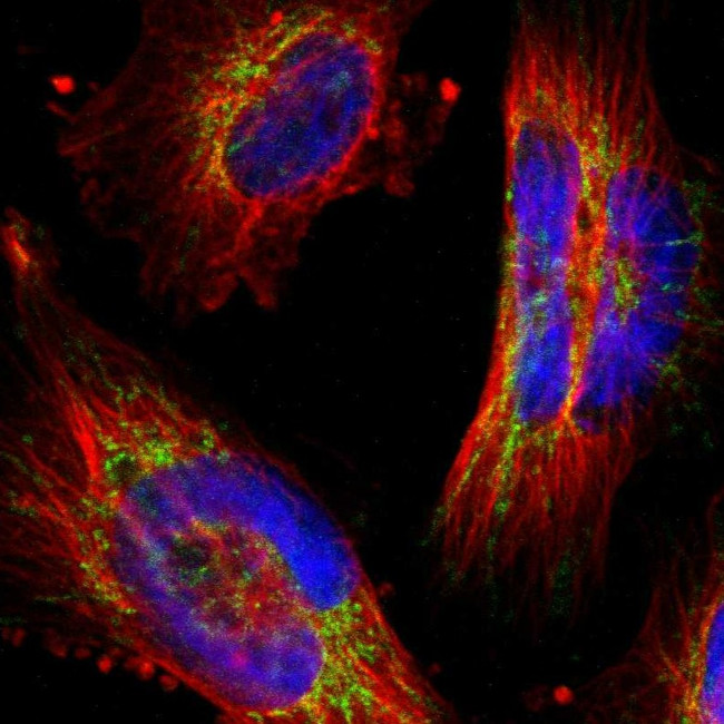 PPFIBP2 Antibody in Immunocytochemistry (ICC/IF)