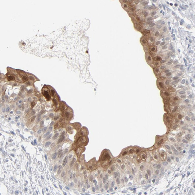 POF1B Antibody in Immunohistochemistry (Paraffin) (IHC (P))