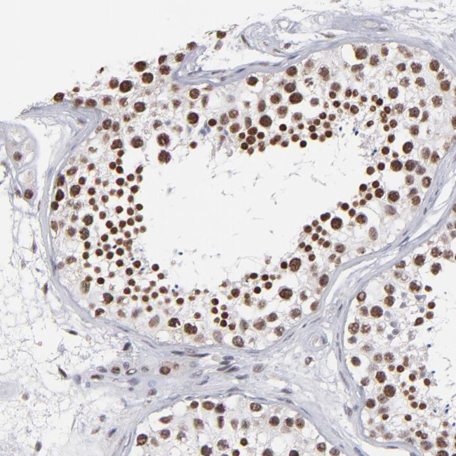 IGF2BP3 Antibody in Immunohistochemistry (IHC)