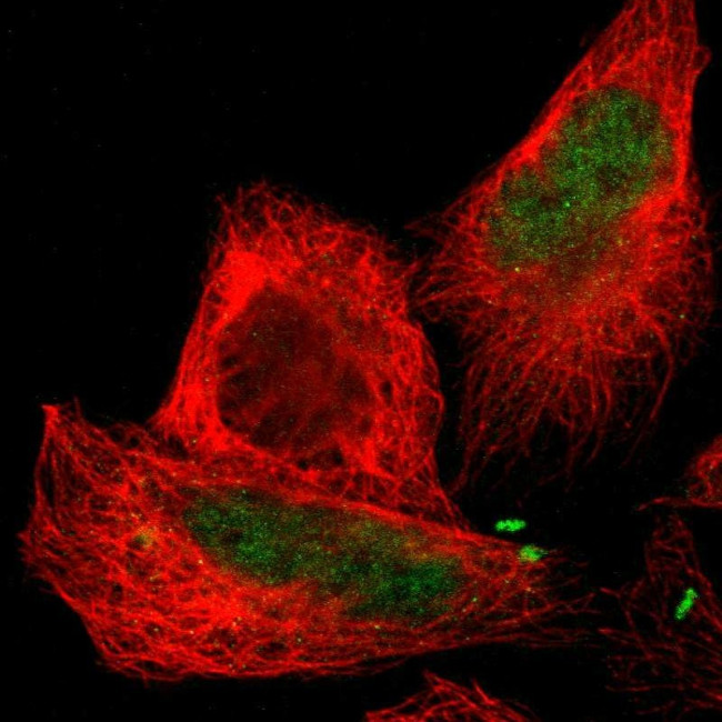CTRP6 Antibody in Immunocytochemistry (ICC/IF)