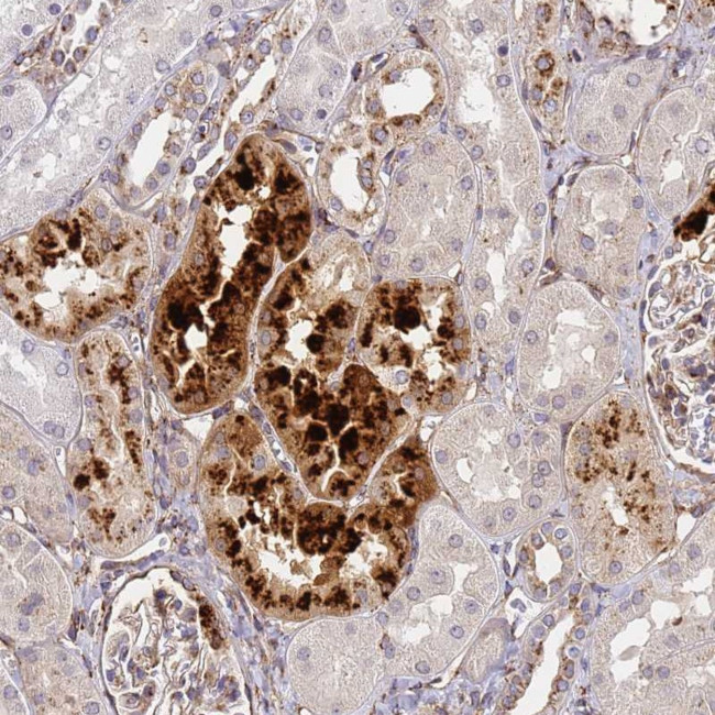 IGFBP7 Antibody in Immunohistochemistry (Paraffin) (IHC (P))