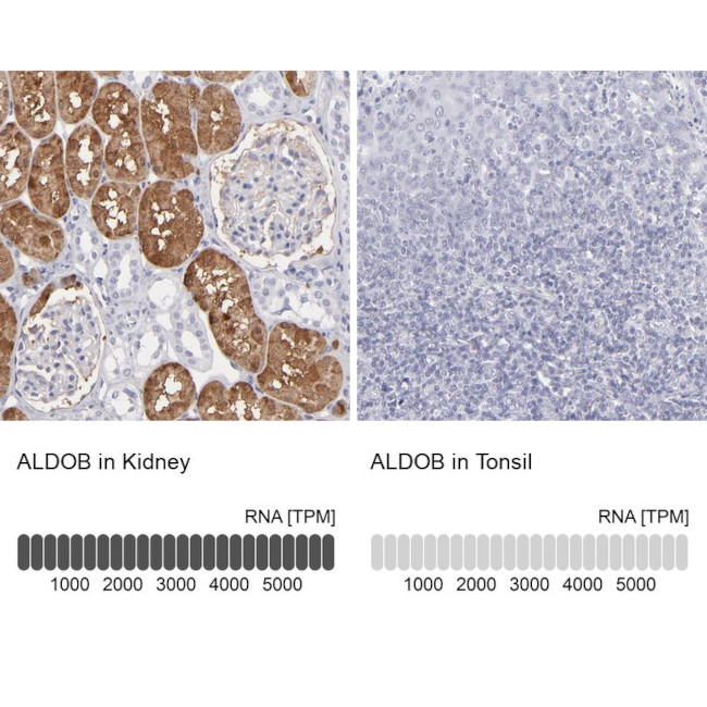 Aldolase B Antibody in Immunohistochemistry (IHC)