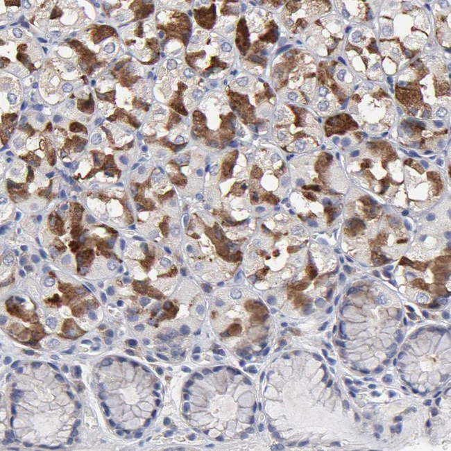 CCDC80 Antibody in Immunohistochemistry (Paraffin) (IHC (P))