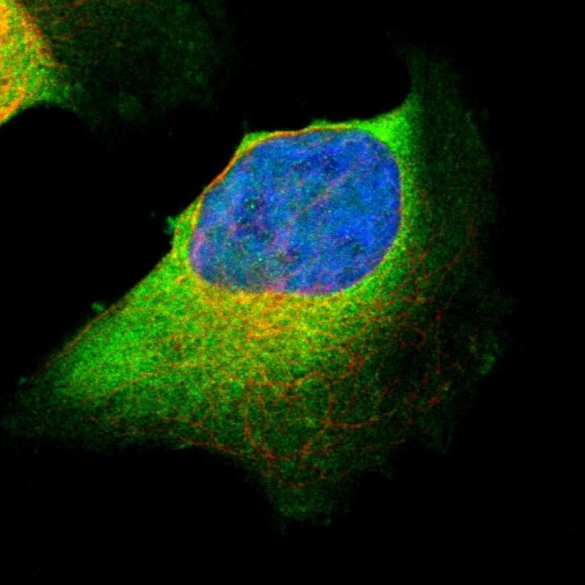 CARS Antibody in Immunocytochemistry (ICC/IF)