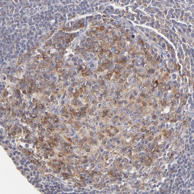 GCSAM Antibody in Immunohistochemistry (Paraffin) (IHC (P))