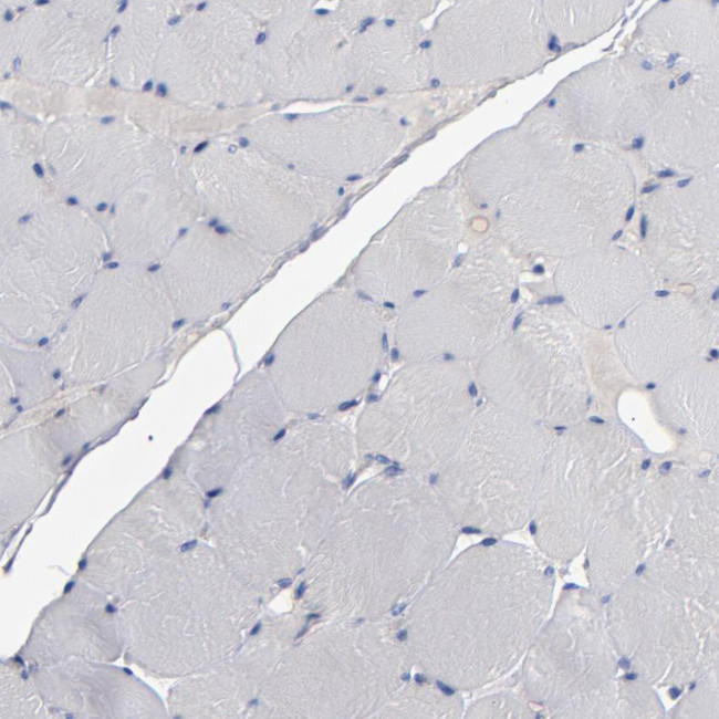 RPH3A Antibody in Immunohistochemistry (Paraffin) (IHC (P))
