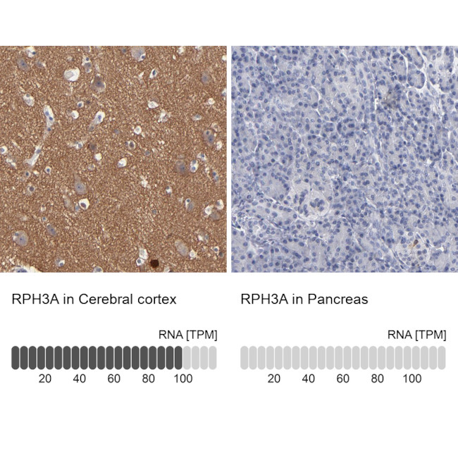 RPH3A Antibody in Immunohistochemistry (IHC)