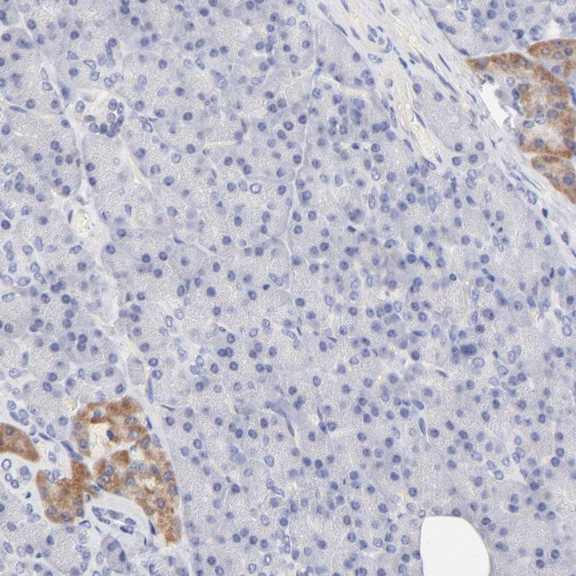 PEO1 Antibody in Immunohistochemistry (Paraffin) (IHC (P))