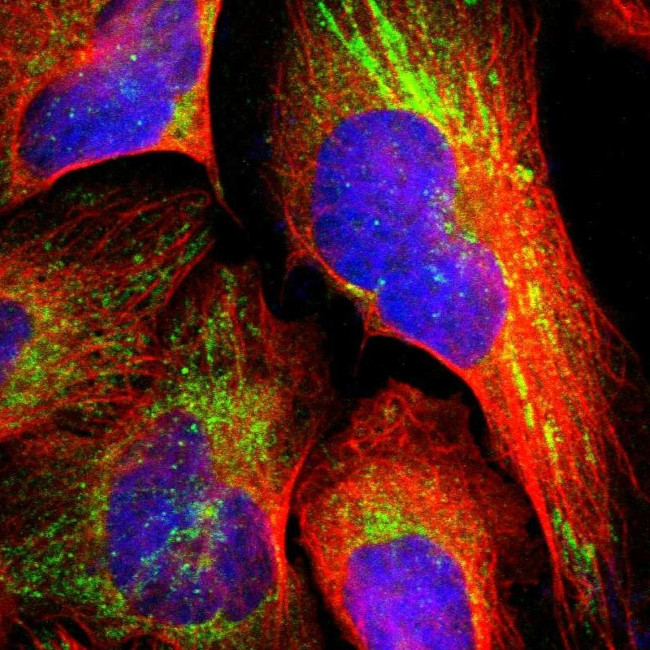 TXNDC16 Antibody in Immunocytochemistry (ICC/IF)