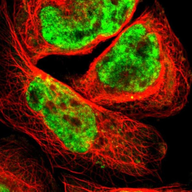SMEK1 Antibody in Immunocytochemistry (ICC/IF)