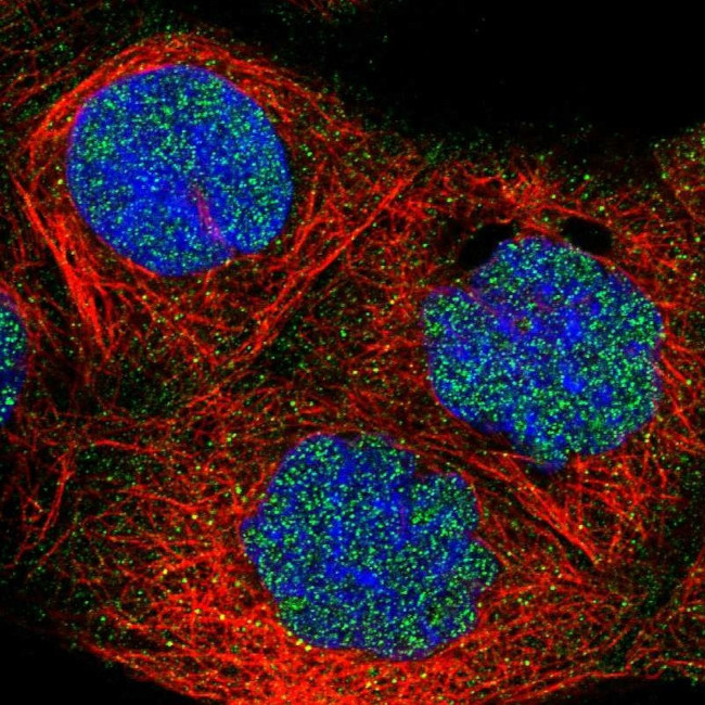 FBXO11 Antibody in Immunocytochemistry (ICC/IF)