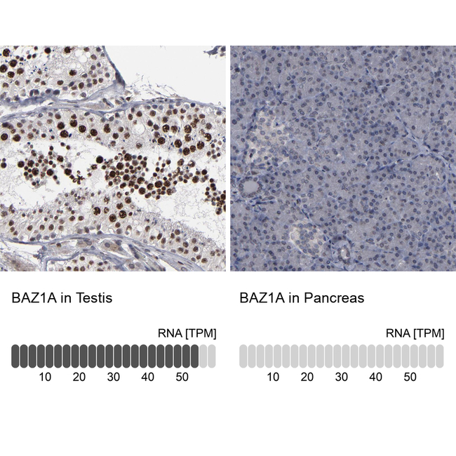 BAZ1A Antibody in Immunohistochemistry (Paraffin) (IHC (P))