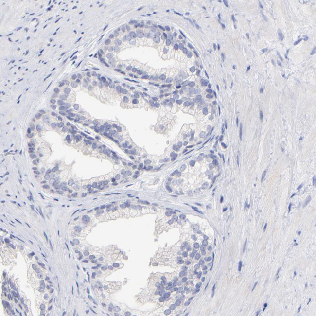 WDR65 Antibody in Immunohistochemistry (Paraffin) (IHC (P))