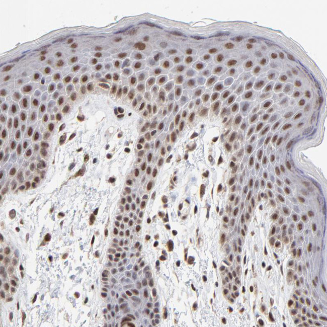 DSN1 Antibody in Immunohistochemistry (Paraffin) (IHC (P))