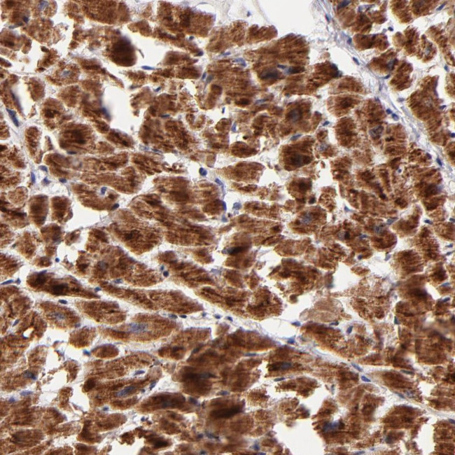 NDUFB7 Antibody in Immunohistochemistry (Paraffin) (IHC (P))