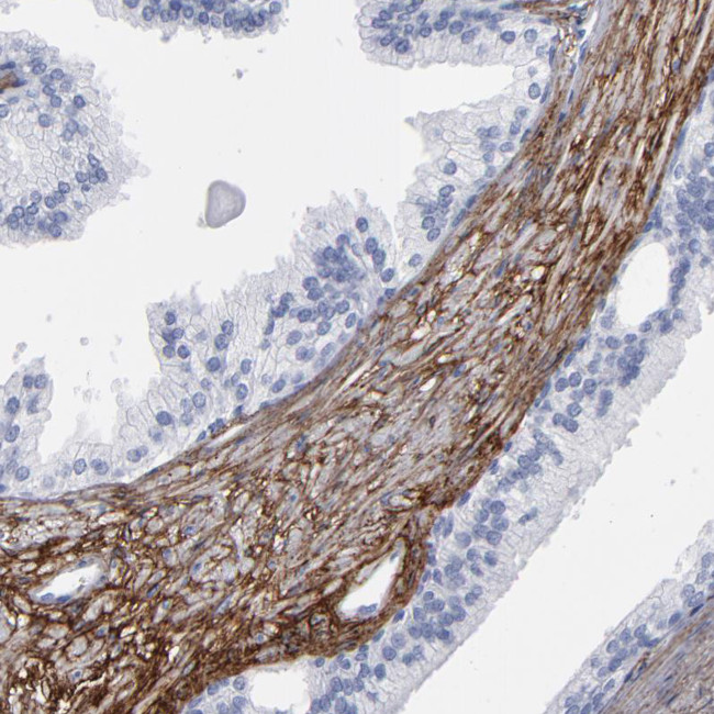 EMILIN1 Antibody in Immunohistochemistry (Paraffin) (IHC (P))