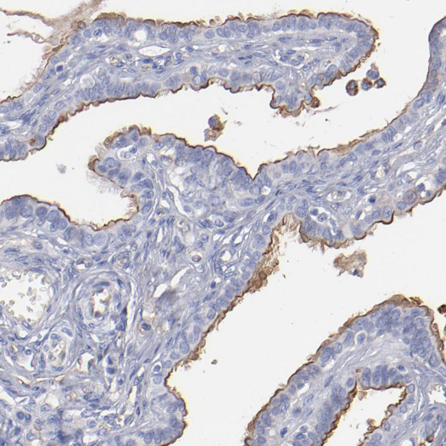 TM4SF1 Antibody in Immunohistochemistry (Paraffin) (IHC (P))