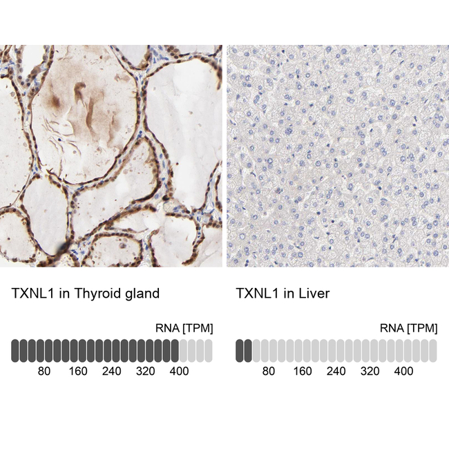 TXNL1 Antibody in Immunohistochemistry (Paraffin) (IHC (P))