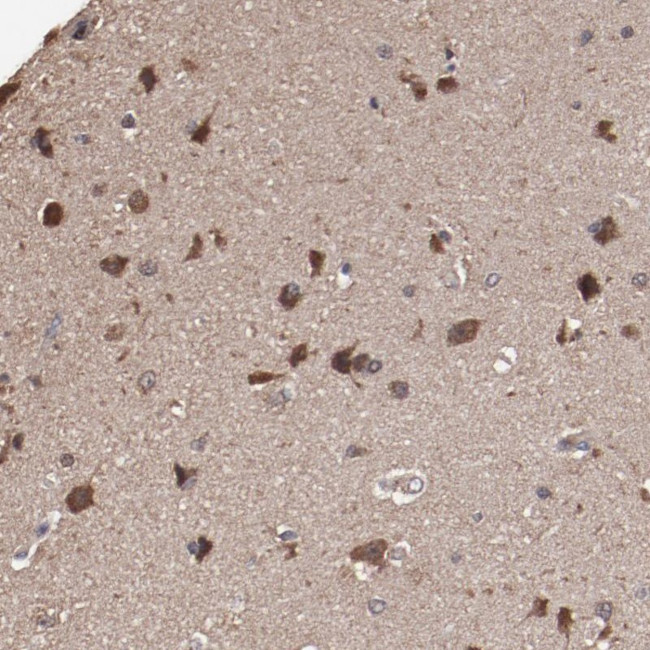 TENM1 Antibody in Immunohistochemistry (Paraffin) (IHC (P))