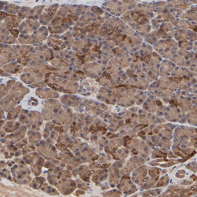FRMD8 Antibody in Immunohistochemistry (Paraffin) (IHC (P))