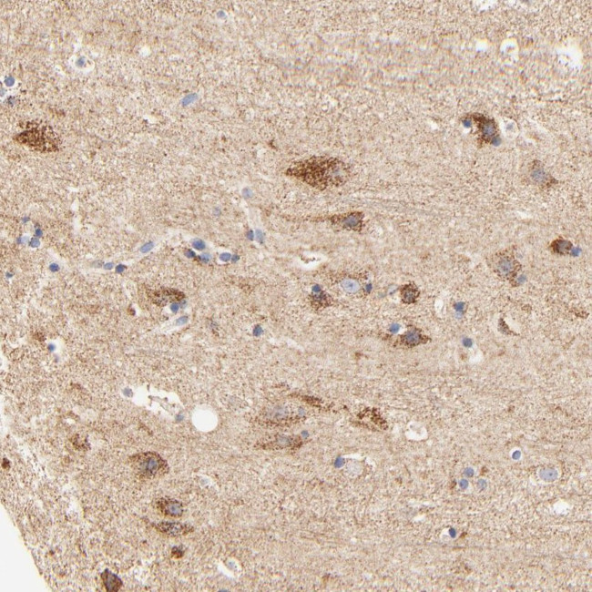 ATP5D Antibody in Immunohistochemistry (Paraffin) (IHC (P))