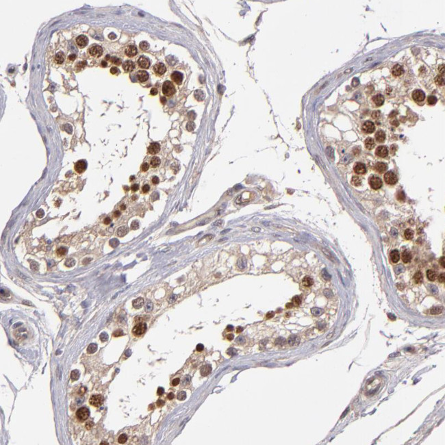 ABHD12B Antibody in Immunohistochemistry (Paraffin) (IHC (P))