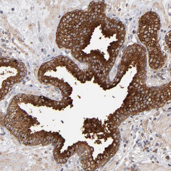 MIPOL1 Antibody in Immunohistochemistry (Paraffin) (IHC (P))