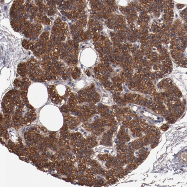 DNAAF2 Antibody in Immunohistochemistry (Paraffin) (IHC (P))