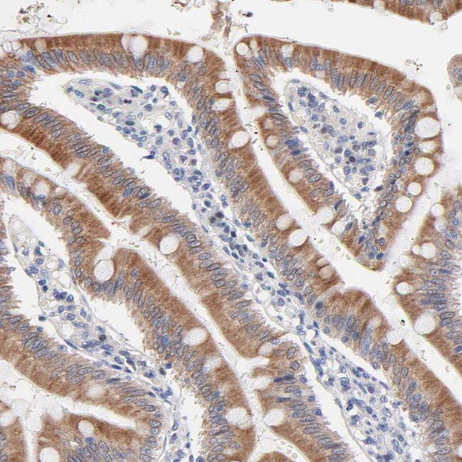 AADAC Antibody in Immunohistochemistry (Paraffin) (IHC (P))