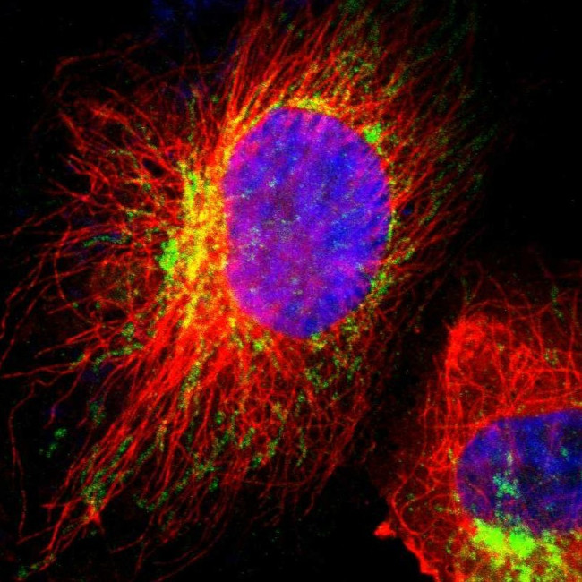 HCCS Antibody in Immunocytochemistry (ICC/IF)