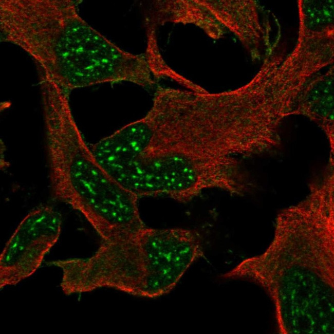 DRP2 Antibody in Immunocytochemistry (ICC/IF)