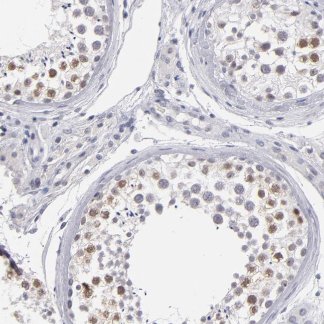 TEX11 Antibody in Immunohistochemistry (Paraffin) (IHC (P))