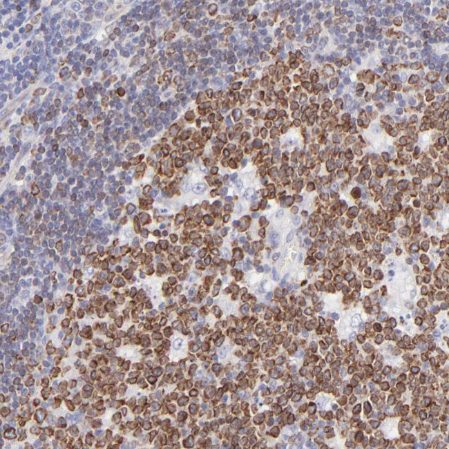 Lrmp Antibody in Immunohistochemistry (Paraffin) (IHC (P))