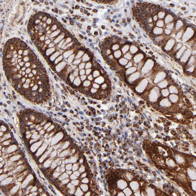 DLST Antibody in Immunohistochemistry (Paraffin) (IHC (P))