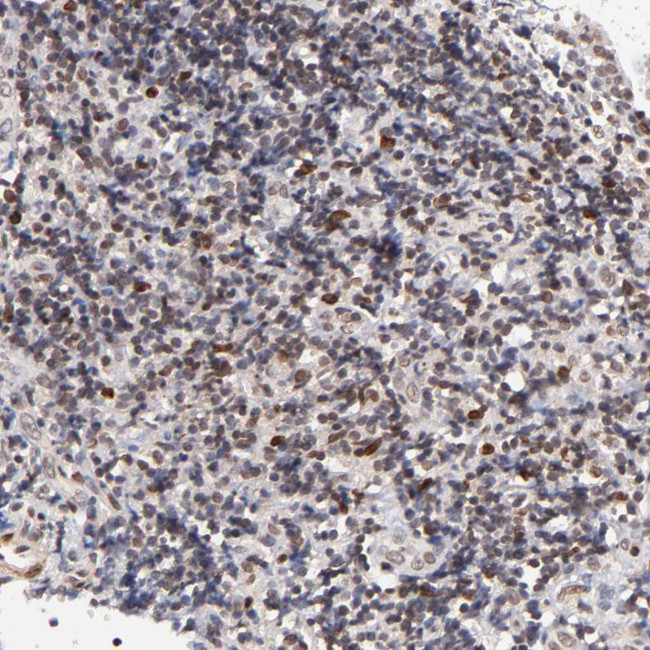 ZFP92 Antibody in Immunohistochemistry (Paraffin) (IHC (P))
