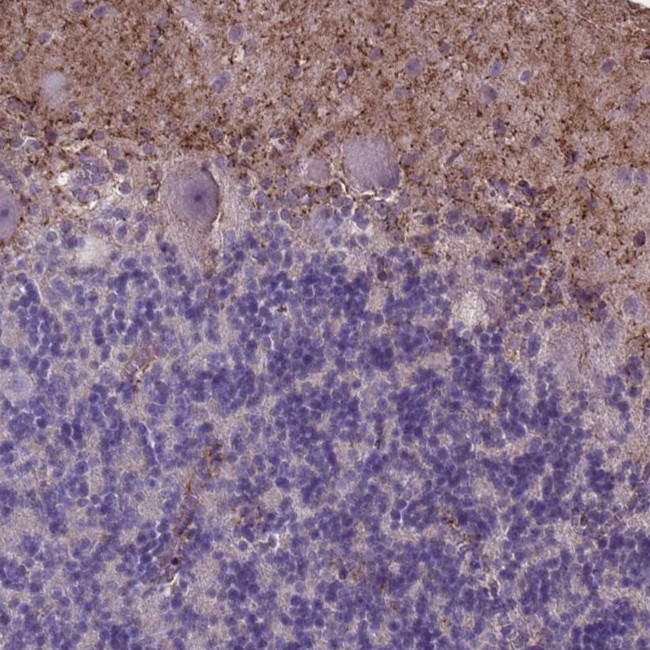 MLC1 Antibody in Immunohistochemistry (Paraffin) (IHC (P))