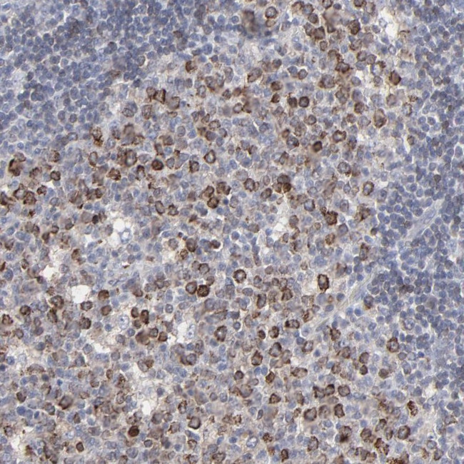 VPREB3 Antibody in Immunohistochemistry (Paraffin) (IHC (P))