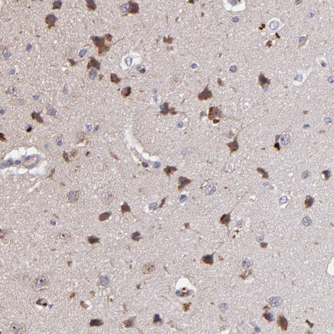 MAGEE1 Antibody in Immunohistochemistry (Paraffin) (IHC (P))