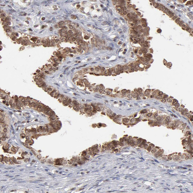 RGS6 Antibody in Immunohistochemistry (Paraffin) (IHC (P))
