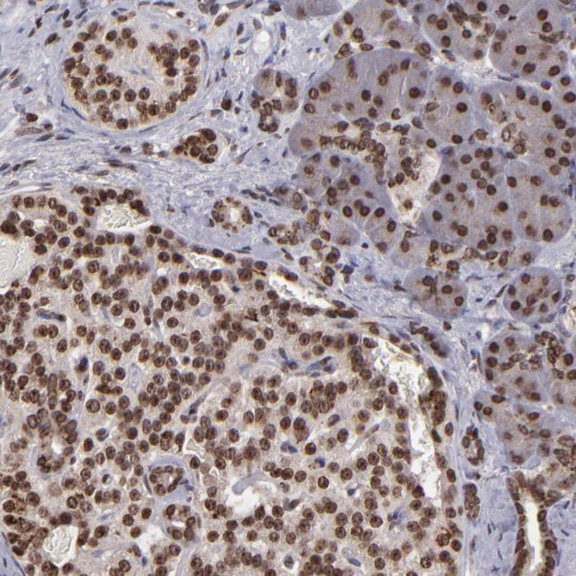 CSDC2 Antibody in Immunohistochemistry (Paraffin) (IHC (P))