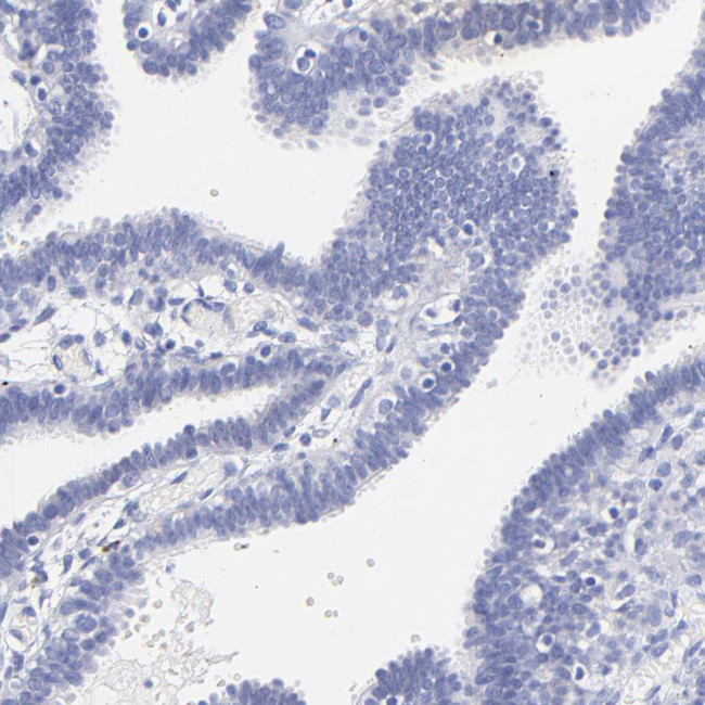 HORMAD2 Antibody in Immunohistochemistry (Paraffin) (IHC (P))