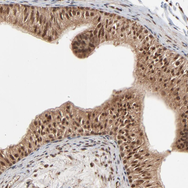 FAM227A Antibody in Immunohistochemistry (Paraffin) (IHC (P))