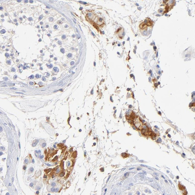 MDGA2 Antibody in Immunohistochemistry (Paraffin) (IHC (P))