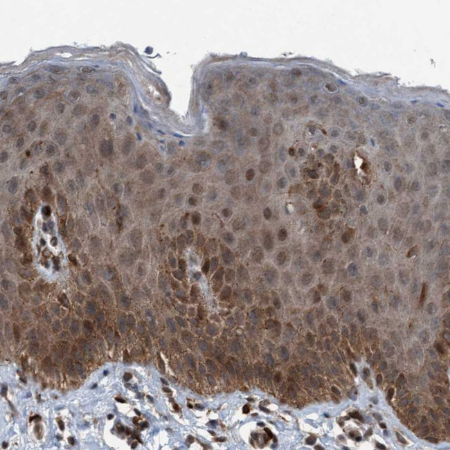 PLXNB2 Antibody in Immunohistochemistry (Paraffin) (IHC (P))