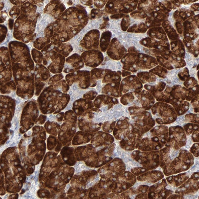 FANCB Antibody in Immunohistochemistry (Paraffin) (IHC (P))