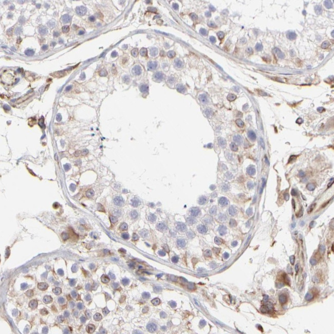 COX8C Antibody in Immunohistochemistry (Paraffin) (IHC (P))