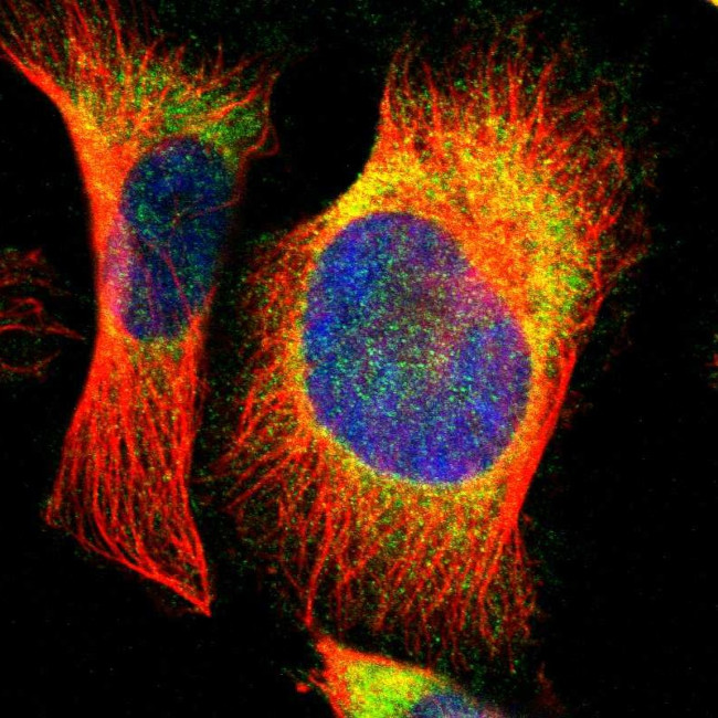 EBP Antibody in Immunocytochemistry (ICC/IF)